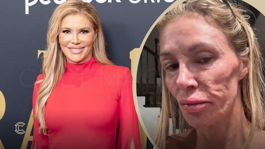 What Happened to Brandi Glanville