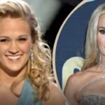 Carrie Underwood Plastic Surgery