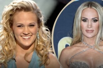 Carrie Underwood Plastic Surgery