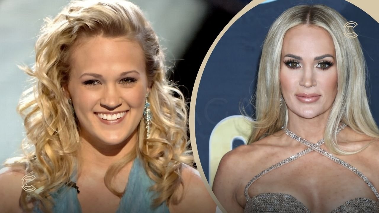Carrie Underwood Plastic Surgery